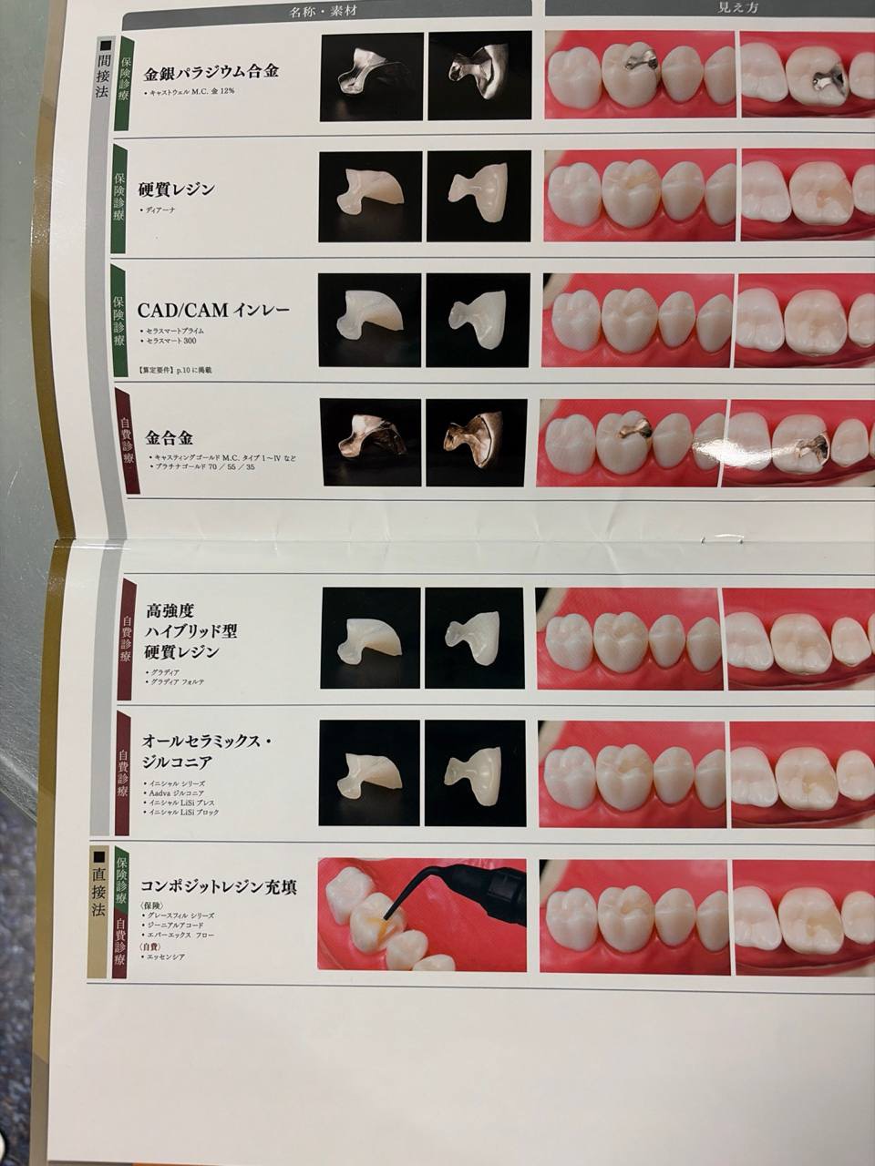 白い詰め物・被せ物、金属の被せ物どう選ぶ？
