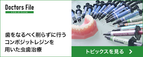 歯をなるべく削らずに行うコンポジットレジンを用いた虫歯治療