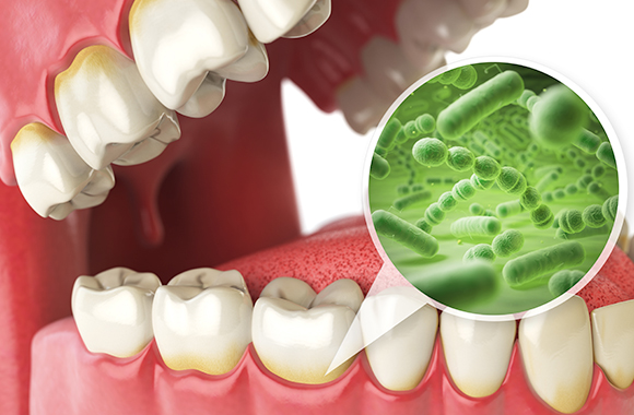 口腔内細菌チェック「お口のなかには細菌がたくさんいる」